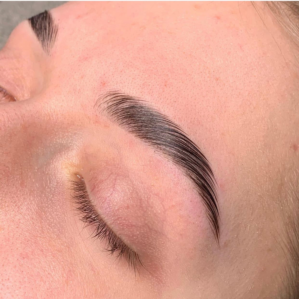 BROWLIFT (Stockholm)