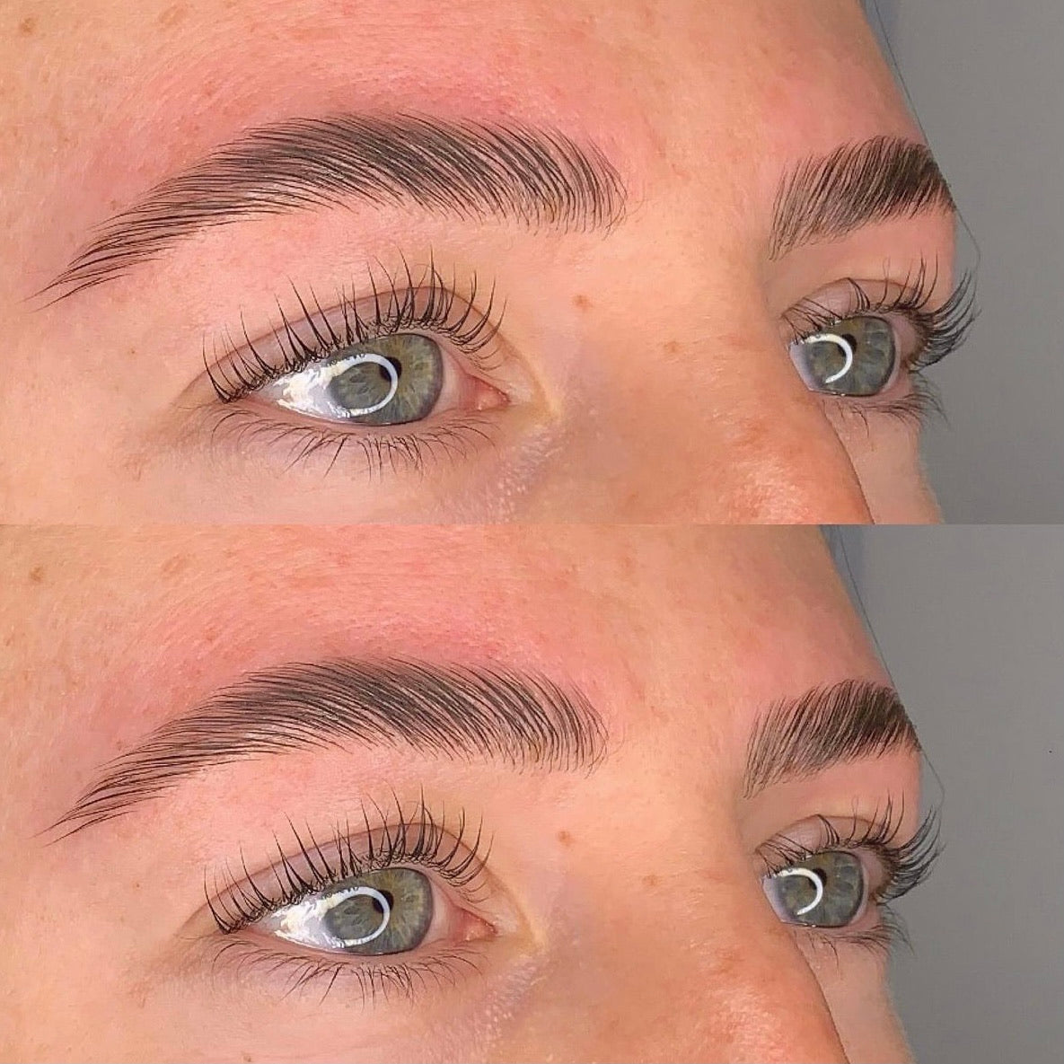 BROWLIFT (Stockholm)