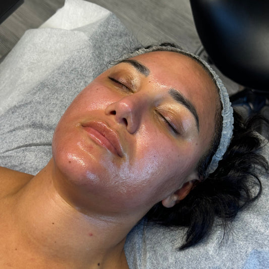Grundutbildning Microneedling | LAX DNA 🧬